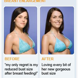 Natural Bigger Breast - How My Friend Shania Got A Bigger Pair Of Breasts Naturally