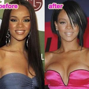 Buy Breast Gain Plus - Breast Enlargement For Big Breasts